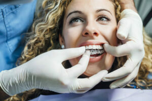 cosmetic dentistry treatments, clear aligners. teeth straightening, invisalign